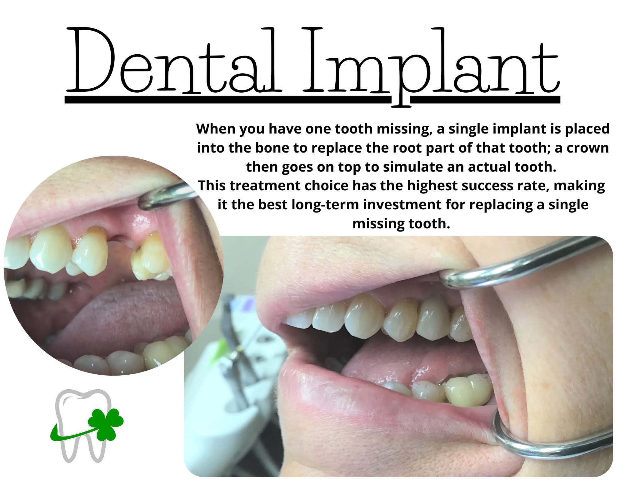 New Haven Dental: dental implants